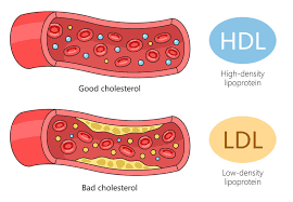 Understanding Cholesterol: Good vs. Bad